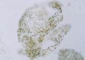 Microcystis wesenbergii (アオコ)